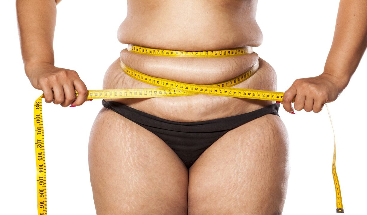 Exceso de peso e perda de peso usando Keto Probiotix